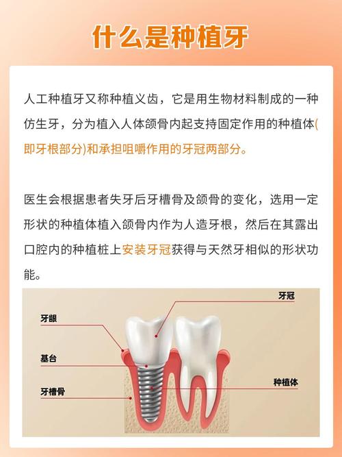 拔完牙后究竟要等多久才能种牙？不同愈合阶段的时间差异和影响种植时机的关键因素有哪些？-图3