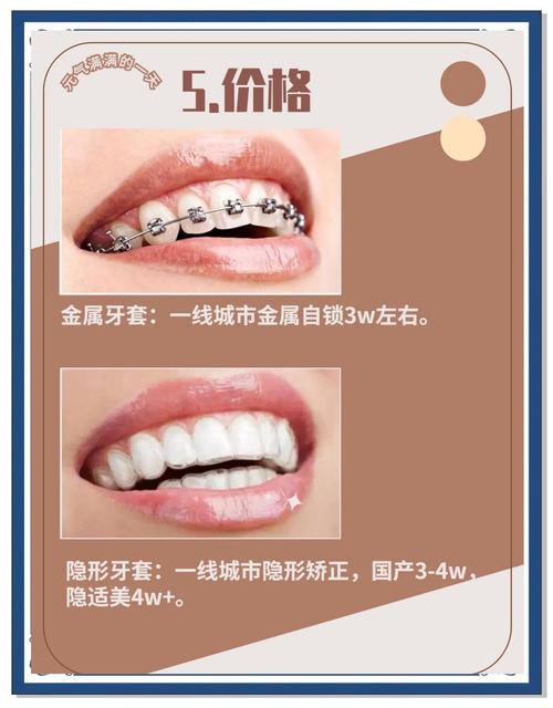 正畸镍钛钢丝的常规选择，临床医生如何根据病例特点确定最优材质与规格？-图3