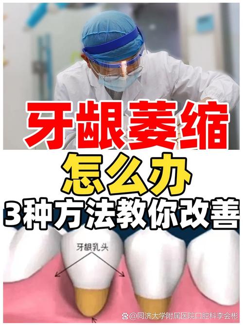 牙龈萎缩后还能种牙吗?需要满足哪些条件?种牙后会有哪些风险需要注意?-图2 牙龈萎缩后还能种牙吗?需要满足哪些条件?种牙后会有哪些风险需要注意?-图2