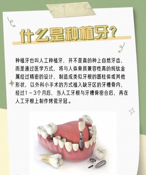 牙齿整形有几种常见方法?不同方法分别适合哪些牙齿问题?效果和优缺点如何?-图2 牙齿整形有几种常见方法?不同方法分别适合哪些牙齿问题?效果和优缺点如何?-图2
