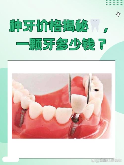 缺一颗牙就必须种一颗吗？种植牙是缺牙修复的唯一选择吗？有哪些利弊和注意事项需提前了解？-图2