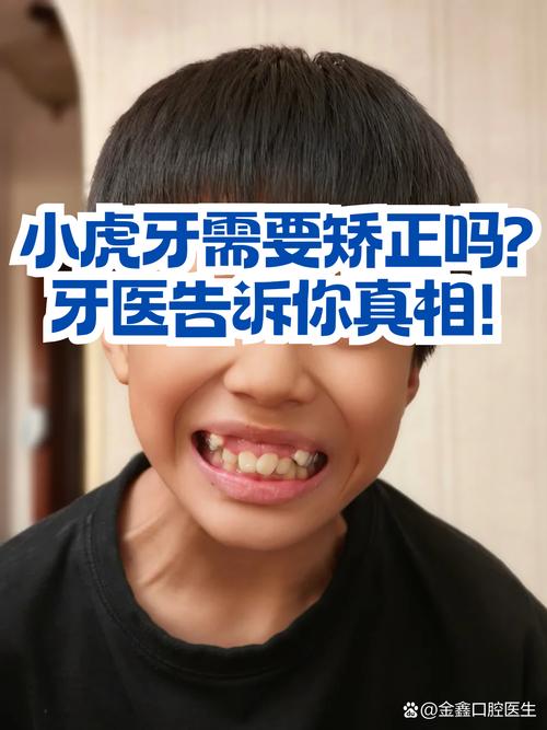 虎牙矫正的最好方法是什么？不同牙齿畸形程度如何选择最优矫正方案？-图1