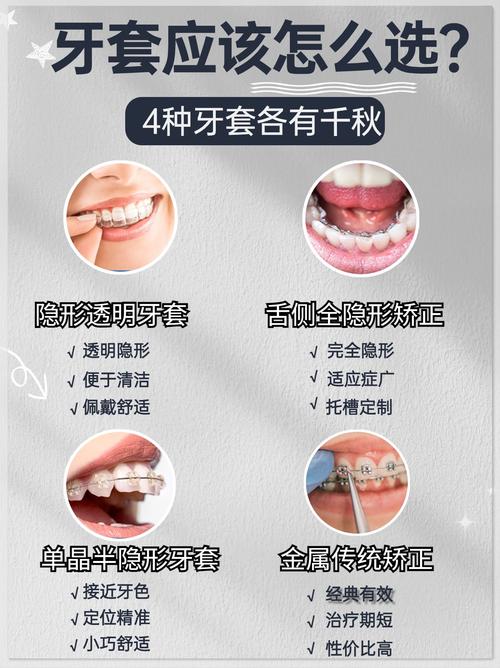 牙套的另一种说法有哪些？从矫正器到牙箍，这些不同名称背后藏着哪些秘密？-图2