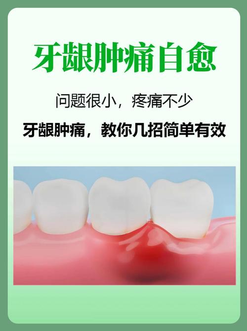 牙龈肿痛时最快消肿方法是什么？真的有立竿见影的妙招吗？多久能见效？有没有副作用？-图1