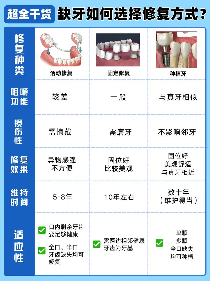 修复牙齿的方法有哪些?不同牙齿问题(蛀牙、缺损、缺失)分别适合哪种修复方式呢?-图2 修复牙齿的方法有哪些?不同牙齿问题(蛀牙、缺损、缺失)分别适合哪种修复方式呢?-图2