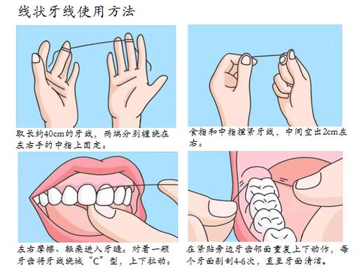 想正确使用牙线却总不得要领?视频演示详细步骤,这些常见错误你犯过吗?-图2 想正确使用牙线却总不得要领?视频演示详细步骤,这些常见错误你犯过吗?-图2