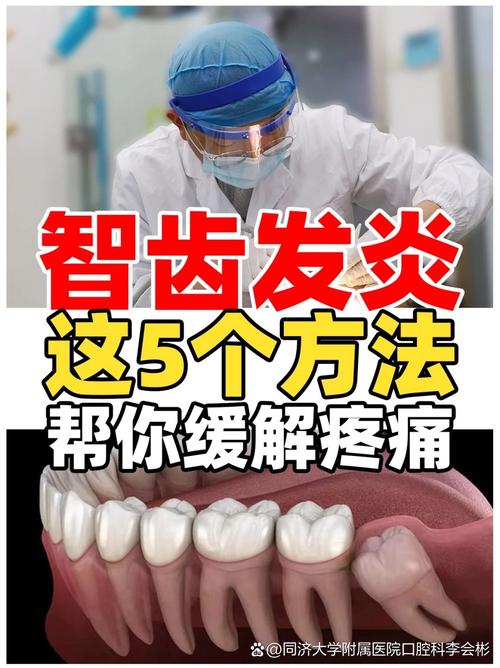 智齿疼痛时如何快速缓解?哪些家庭护理方法安全有效,什么情况下必须及时就医处理?-图3 智齿疼痛时如何快速缓解?哪些家庭护理方法安全有效,什么情况下必须及时就医处理?-图3