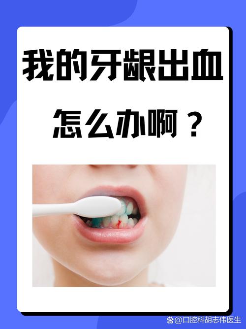 不同原因导致的牙龈出血有哪些有效的治疗方法？日常护理和医疗干预如何结合？-图1