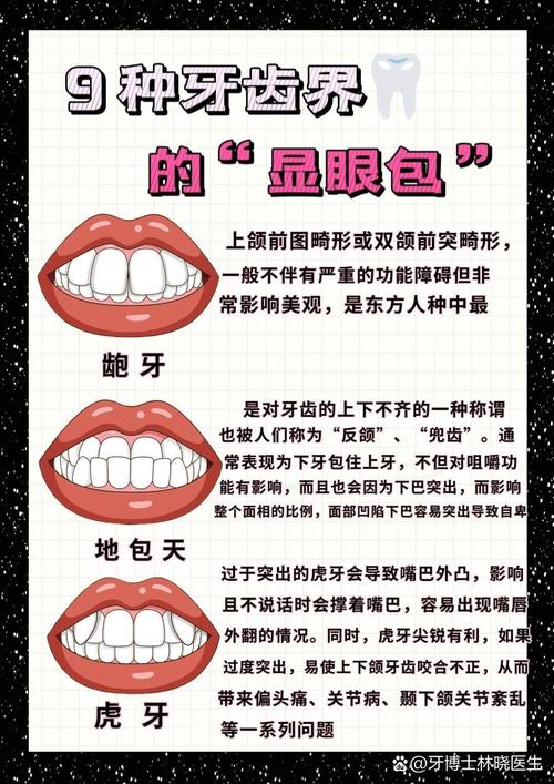 矫正牙齿有几种方法？不同矫正方式各有哪些优缺点，该如何选择适合自己的？-图3