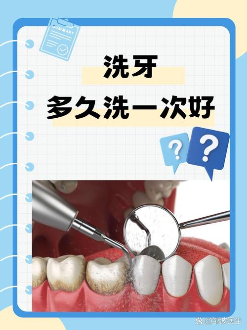 哪一种洗牙方法好-图2