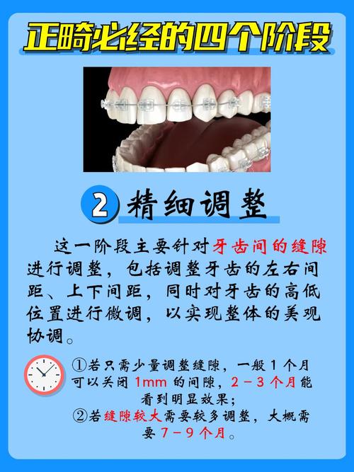 临面去釉矫正方法是什么原理？它主要针对哪些牙齿错颌问题？操作过程是否安全，会对牙齿造成永久损伤吗？-图3