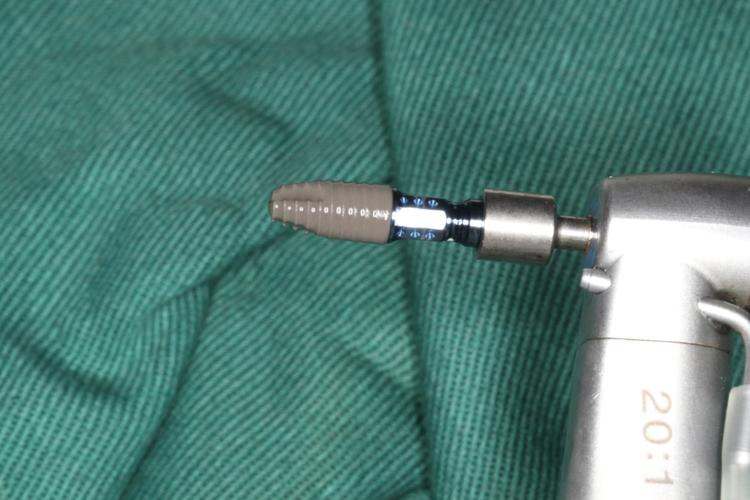 江苏省常州市种牙价格差异大?不同医院的技术、服务与效果如何对比选择?-图3 江苏省常州市种牙价格差异大?不同医院的技术、服务与效果如何对比选择?-图3