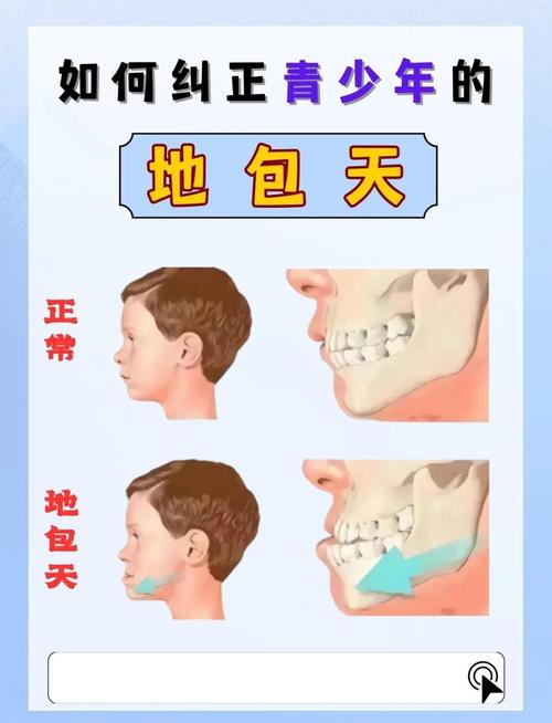 天包地矫正术有哪些主流方法?不同矫正方式的效果、周期及适用人群如何选择?-图3 天包地矫正术有哪些主流方法?不同矫正方式的效果、周期及适用人群如何选择?-图3