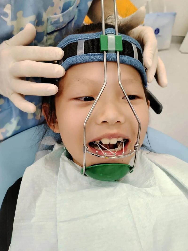 天包地矫正术有哪些主流方法？不同矫正方式的效果、周期及适用人群如何选择？-图2