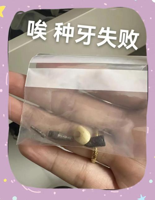 种牙一段式失败率为何居高不下？背后隐藏哪些技术风险与术后隐患？-图2