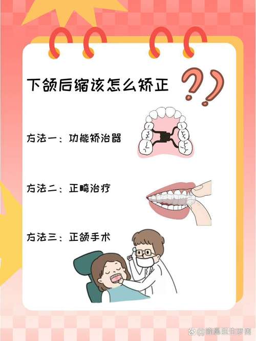 上下颚骨矫正方法有哪些?不同年龄和错颌畸形类型该如何选择合适的矫正方案?-图3 上下颚骨矫正方法有哪些?不同年龄和错颌畸形类型该如何选择合适的矫正方案?-图3
