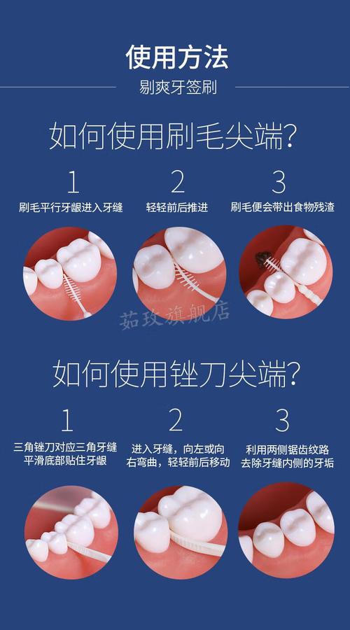 间齿刷的正确使用方法是什么?新手必看的清洁步骤、适用频率及注意事项全解析-图2 间齿刷的正确使用方法是什么?新手必看的清洁步骤、适用频率及注意事项全解析-图2