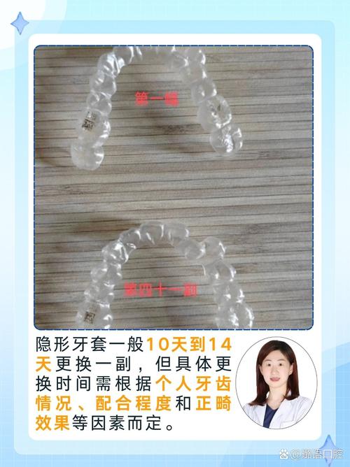 隐形正畸的效果究竟怎么样？美观度、舒适度、矫正效果和周期真的能兼顾吗？-图2