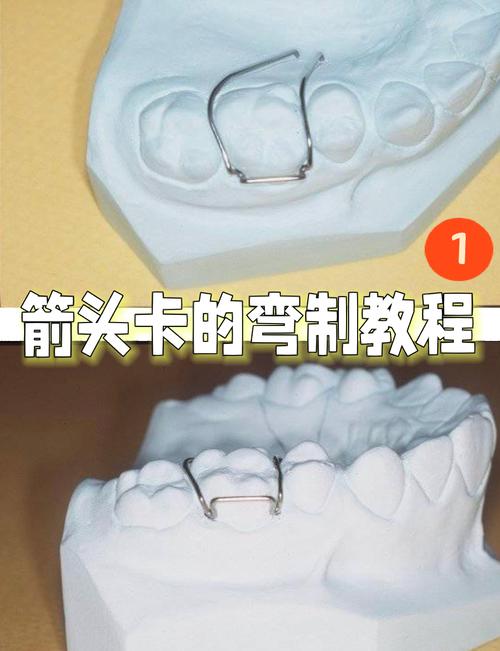 箭头卡弯制时如何精准控制弯曲角度并避免材料变形？具体操作步骤和工具选择有哪些关键要点？-图1