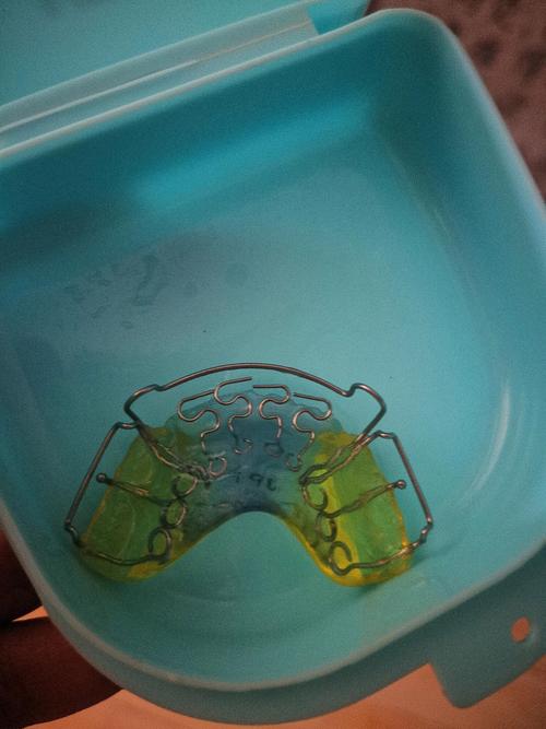 葛立宏医生谈儿童口腔正畸，不同年龄段孩子矫正的黄金期有何差异？-图2