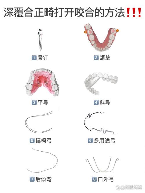 如何正确掌握咬合架的使用方法？不同口腔修复场景下的操作步骤与注意事项有哪些？-图2