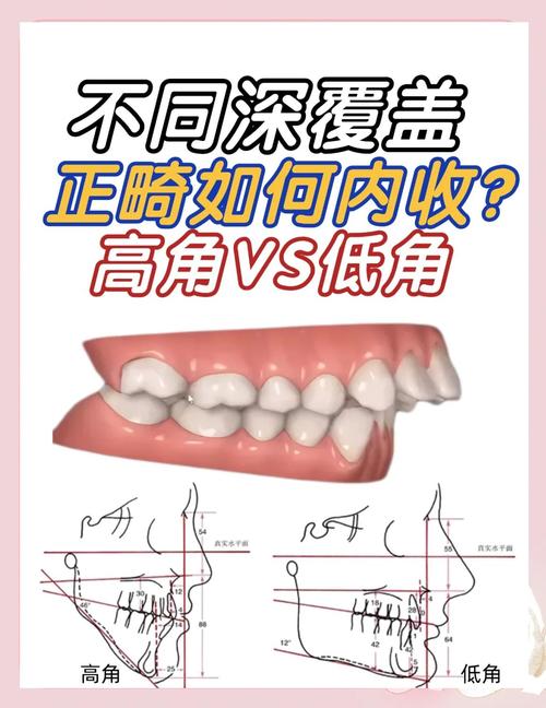 牙冠折患者正畸治疗中延长牙冠距离的适应症与临床效果如何评估?-图1 牙冠折患者正畸治疗中延长牙冠距离的适应症与临床效果如何评估?-图1