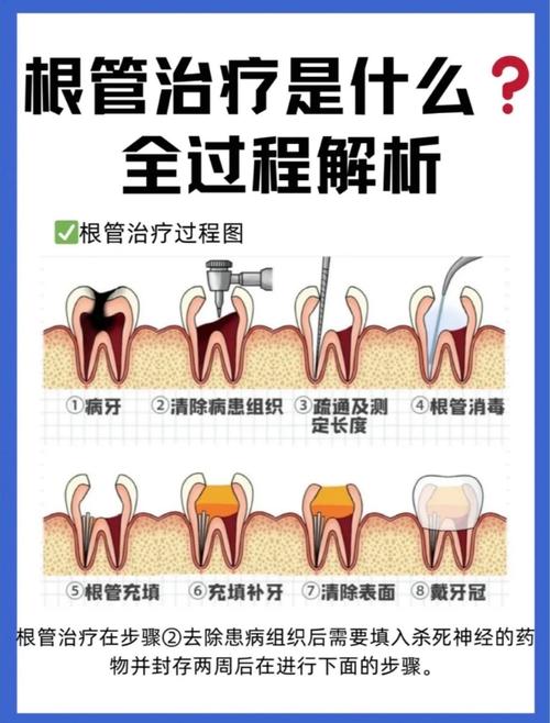 冠牙炎有哪些治疗方法？不同严重程度下如何选择治疗方式？日常护理对治疗效果有何影响？-图3