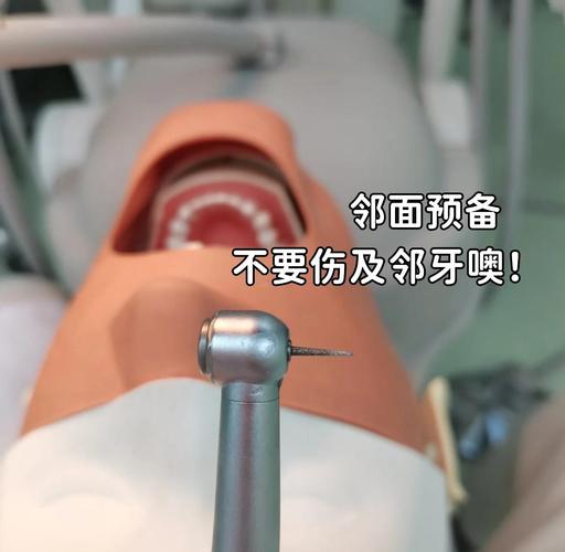 上颌第一磨牙备牙方法有哪些？不同适应症（全冠/嵌体）下如何精准操作并规避常见并发症？-图3