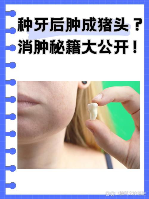 种牙后脸部肿胀怎么办?是正常术后反应还是感染信号?如何正确处理才能避免恶化?-图2 种牙后脸部肿胀怎么办?是正常术后反应还是感染信号?如何正确处理才能避免恶化?-图2