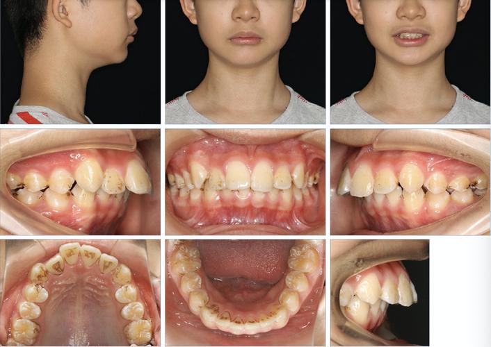 公立专科口腔医院做正畸有哪些独特优势？技术、费用和效果如何与其他机构区分？-图1
