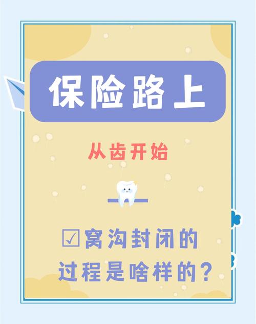 窝沟封闭操作方法的具体步骤是怎样的？操作中如何把握酸蚀时间与光照强度以确保封闭效果？-图2