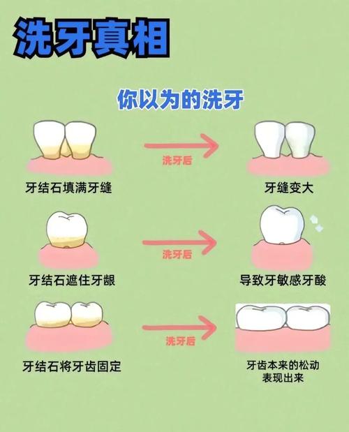 在口腔修复临床操作中，常用的排龈方法有哪些？不同方法的具体操作步骤、适应症及注意事项分别是什么？-图3