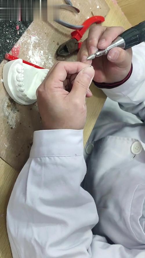 在口腔修复全冠蜡制作中,如何通过堆塑、雕刻技巧确保蜡型与患牙的精准适配及功能稳定性?-图2 在口腔修复全冠蜡制作中,如何通过堆塑、雕刻技巧确保蜡型与患牙的精准适配及功能稳定性?-图2