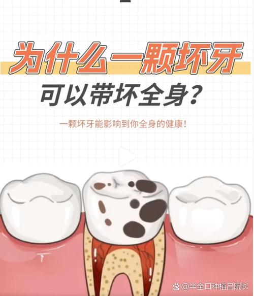 血液病患者能否安全种牙?需警惕哪些风险与术前准备?-图1 血液病患者能否安全种牙?需警惕哪些风险与术前准备?-图1