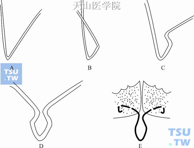 舌簧弯制方法图解中，具体弯制步骤有哪些？如何通过图示掌握关键技巧与常见问题解决方法？-图1
