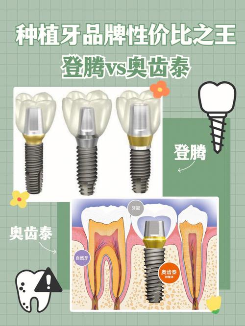 奥齿泰和登腾种植牙到底怎么选?从价格、耐用性到医生适配性全面对比哪个更值得入手?-图1 奥齿泰和登腾种植牙到底怎么选?从价格、耐用性到医生适配性全面对比哪个更值得入手?-图1