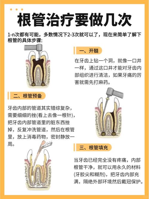 侧牙根管治疗有哪些主流方法？不同方法在适应症、操作技巧及疗效上有何差异？-图1