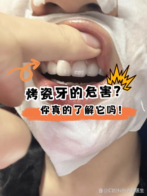 已经做过烤瓷牙的人，是否还能进行种植牙修复？有哪些注意事项和潜在影响需要考虑？-图1