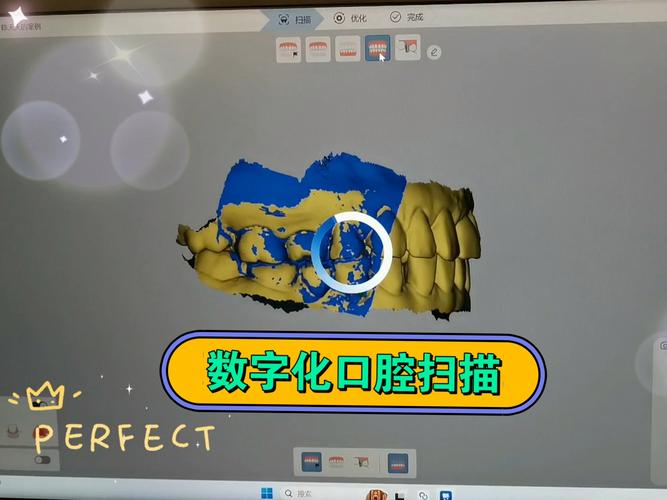 口腔印模制作方法中，材料选择、操作步骤及常见错误如何影响印模精准度与临床适配性？-图3