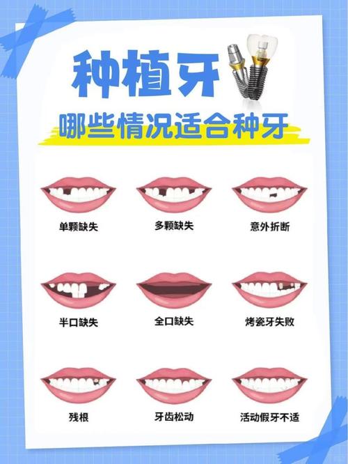 种牙后究竟能否像真牙一样正常饮食？恢复期需要多久才能咀嚼硬食，日常饮食有哪些注意事项？-图2