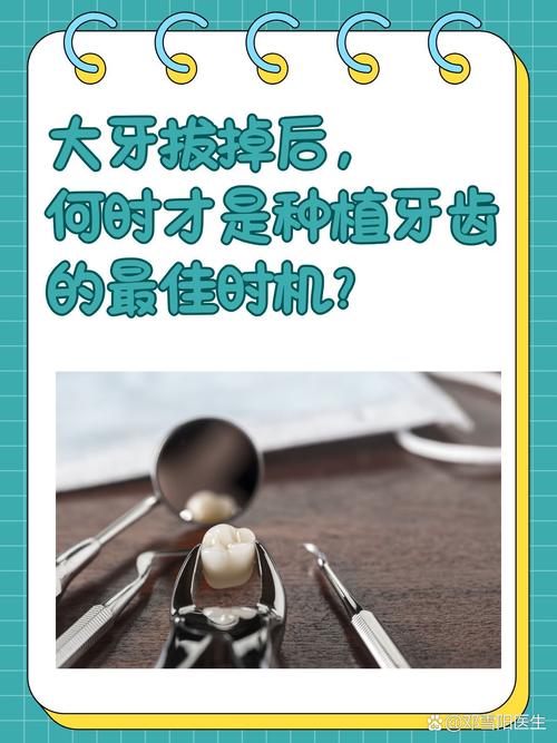 拔牙后马上种牙真的靠谱吗？即刻种植的可行性、风险与注意事项，你了解多少？-图2