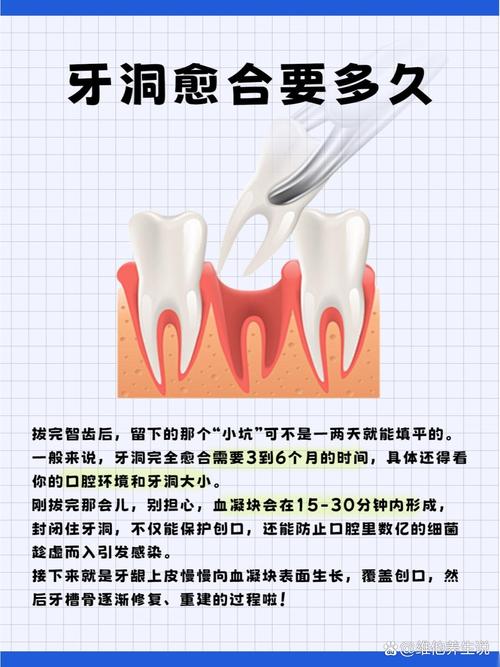 拔牙后为何要等6个月才能种牙?这段时间牙齿和牙槽床究竟在经历什么变化?-图2 拔牙后为何要等6个月才能种牙?这段时间牙齿和牙槽床究竟在经历什么变化?-图2
