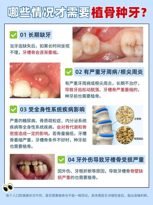 种牙骨可能出现哪些不良反应？这些反应的产生原因是什么？如何科学应对并有效降低发生风险？-图2