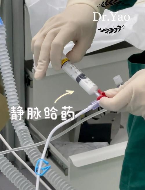 斯康杜尼麻醉方法的具体操作流程是怎样的?其适用范围和潜在风险有哪些?与传统麻醉方式相比有何优势?-图1 斯康杜尼麻醉方法的具体操作流程是怎样的?其适用范围和潜在风险有哪些?与传统麻醉方式相比有何优势?-图1