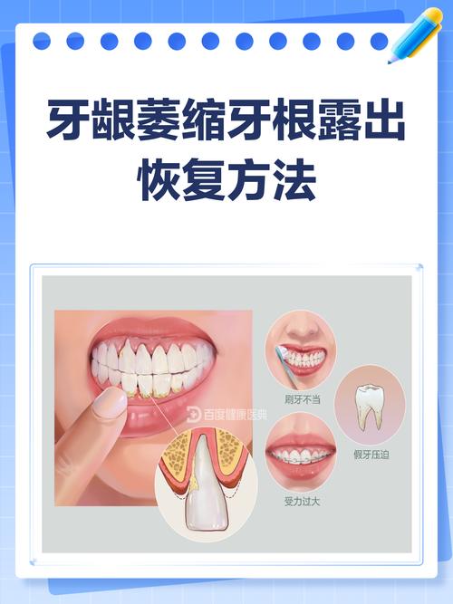 牙周自我修复方法真的存在吗？日常有哪些具体步骤能科学促进牙周健康恢复？-图1
