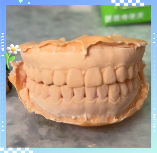 取牙模的正确方法-图2