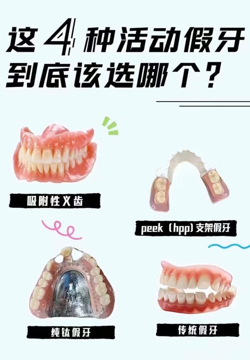 树脂美视的具体方法有哪些?操作时需注意哪些细节?效果能维持多久?是否存在副作用?-图1 树脂美视的具体方法有哪些?操作时需注意哪些细节?效果能维持多久?是否存在副作用?-图1