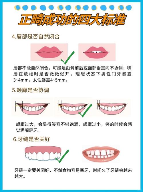 成人正畸的施力原则有何特殊性?如何平衡牙齿移动效率与牙周组织的健康?-图3 成人正畸的施力原则有何特殊性?如何平衡牙齿移动效率与牙周组织的健康?-图3