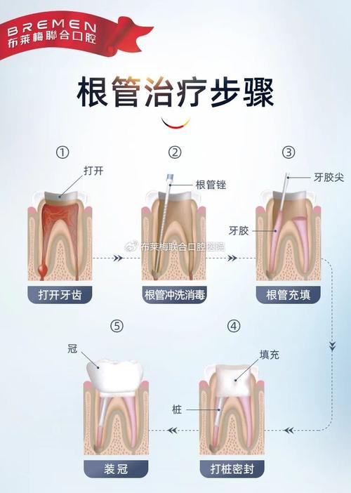 显微根管治疗的具体操作步骤有哪些？新手医生如何快速掌握其使用技巧并避免常见操作误区？-图2