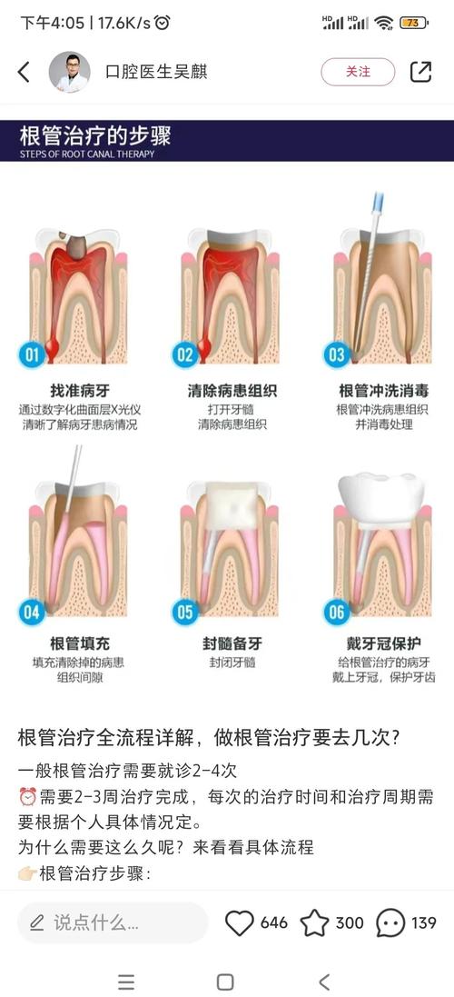 分根术的手术方法具体如何操作？不同适应症下的关键步骤、技术细节及术后注意事项有哪些？-图3